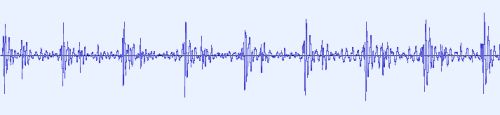 [a graph in Audacity showing a recording of heart beats]